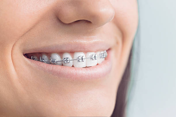 Best Teeth Whitening  in Harris Hill, NY